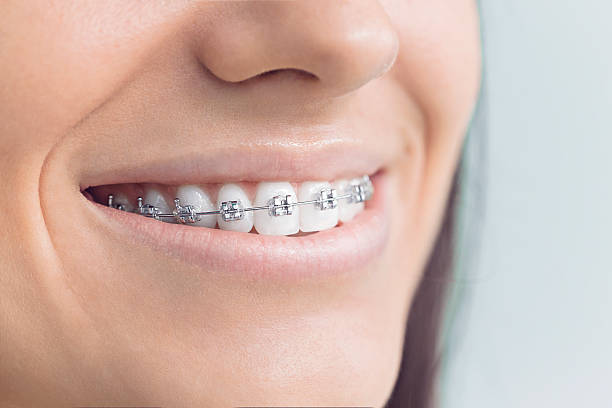 Best Invisalign and Clear Aligners  in Hancock, MD